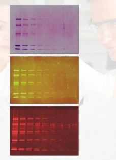 Fluorescent Protein Stains 